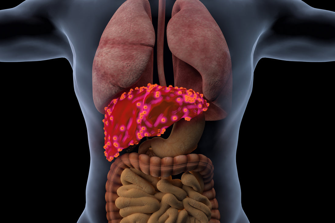 Fatty Liver Disease Treatment: Remedies and Ayurvedic Solutions